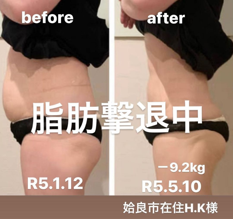 鹿児島・姶良市・福岡の痩身エステ