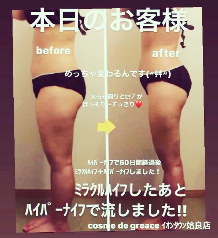 苫小牧店・千歳店の痩身エステ