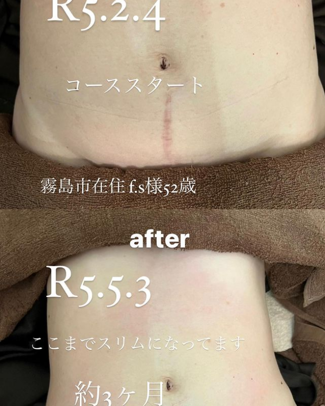 福岡・鹿児島・姶良市の痩身エステ