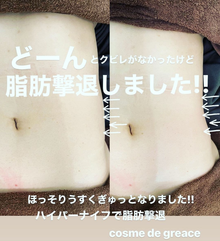 福岡・鹿児島・姶良市の痩身エステ