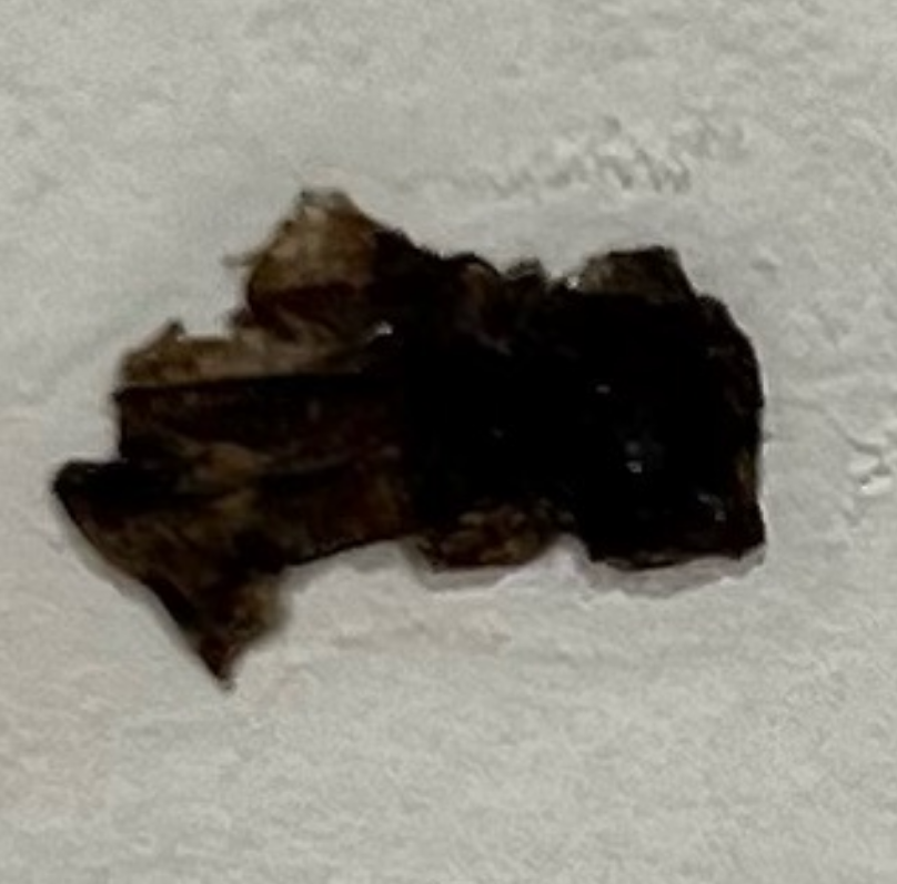 福岡・鹿児島・姶良市のシミ取り