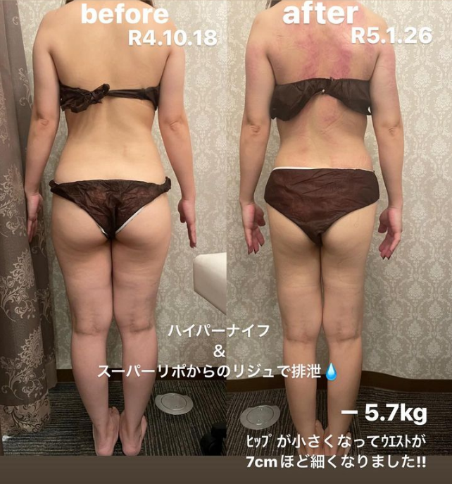 福岡・鹿児島・姶良市の痩身エステ