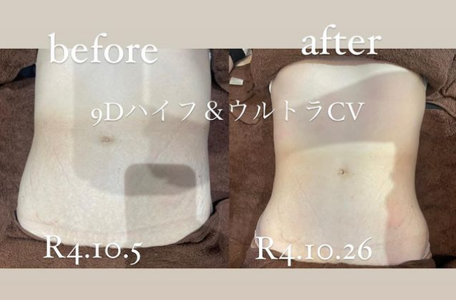 福岡・鹿児島・姶良市の痩身エステ