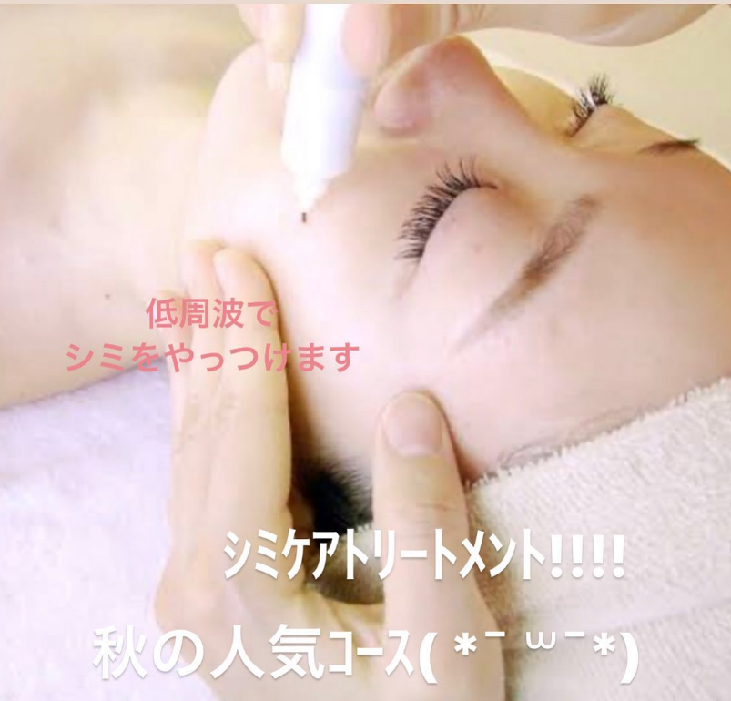 鹿児島・姶良市のシミ取り